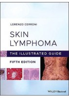 SKIN LYMPHOMA. THE ILLUSTRATED GUIDE