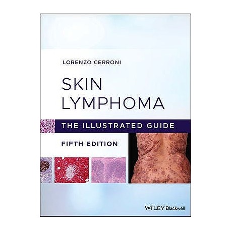 SKIN LYMPHOMA. THE ILLUSTRATED GUIDE