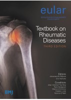 EULAR TEXTBOOK ON RHEUMATIC DISEASES