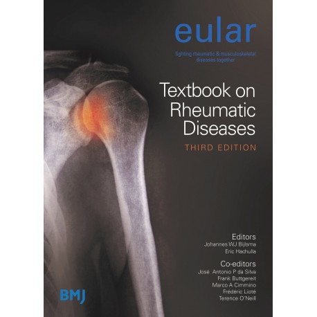EULAR TEXTBOOK ON RHEUMATIC DISEASES