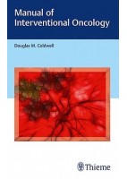 MANUAL OF INTERVENTIONAL ONCOLOGY