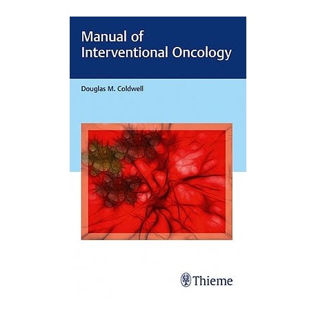 MANUAL OF INTERVENTIONAL ONCOLOGY