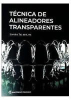 LA TECNICA DEL ALINEADOR TRANSPARENTE