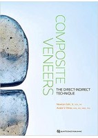 COMPOSITE VENEERS. THE DIRECT-INDIRECT TECHNIQUE